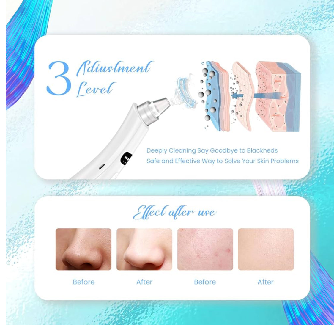 Aspiradora de poros removedor de puntos negros, 4 potencia de succión, 4 sondas, kit de vacío de puntos negros recargable USB - limpiador de poros facial, herramienta eléctrica para extractor de acné para mujeres y hombres